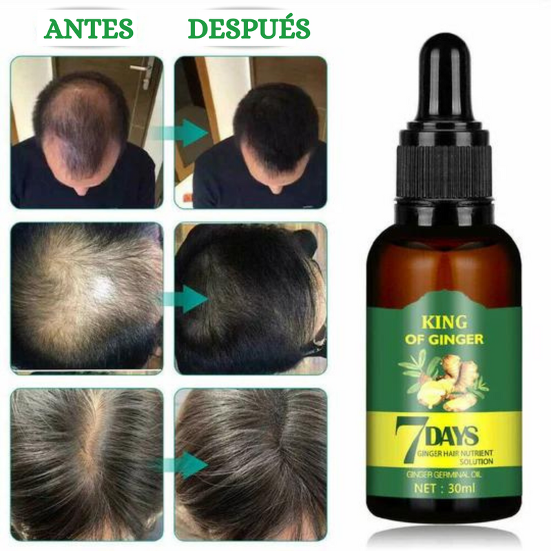 Majestad de Jengibre para Cabello y Barba